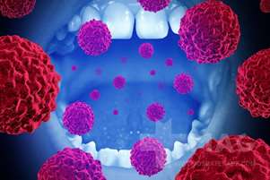 سرطان دهان(oral cancer)  چیست و چه بخش‌هایی را درگیر می‌کند؟