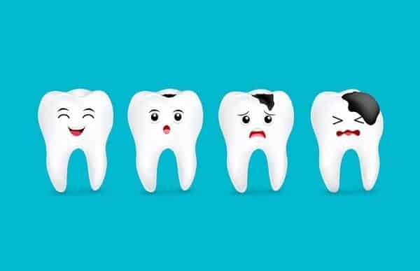 روش های پیشگیری از پوسیدگی دندان